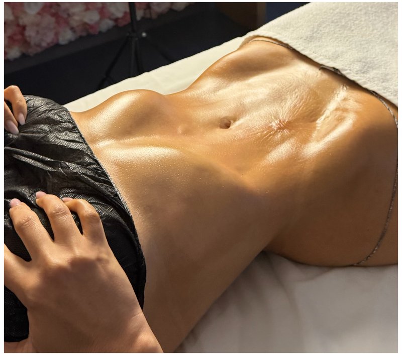 Abdômen após a sessão de Ultradrenagem Corporal, com contorno evidenciado