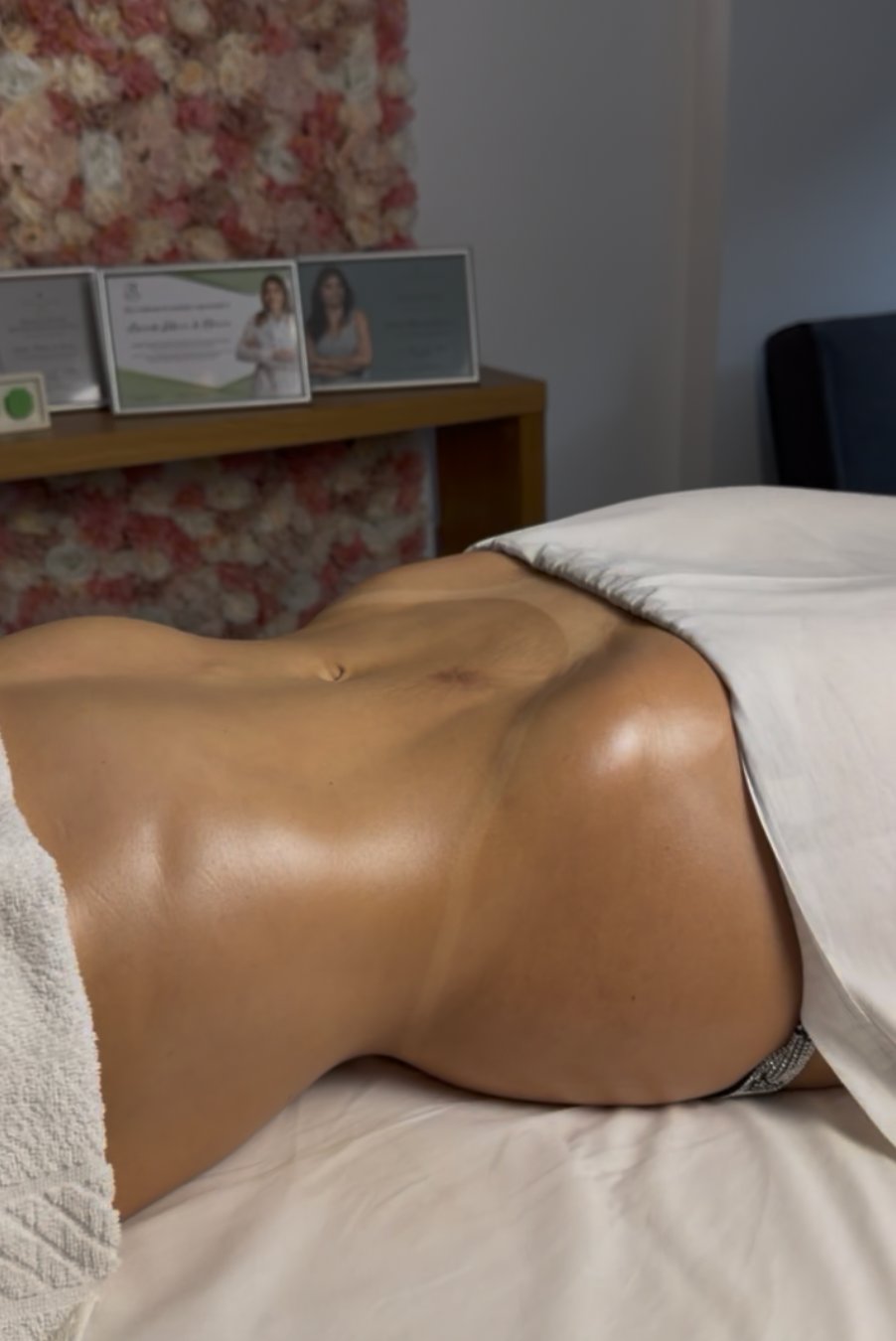 Resultado de Ultradrenagem Corporal — abdômen com contorno definido, no gabinete da Amanda Ribeiro com certificados profissionais ao fundo